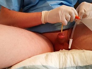 Remplir la vessie avec sa propre urine à l'aide d'un cathéter