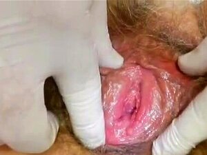Gyno joueux et doux à la clinique