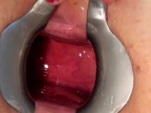 Baise anale extrême avec un gode et autre dans une chatte